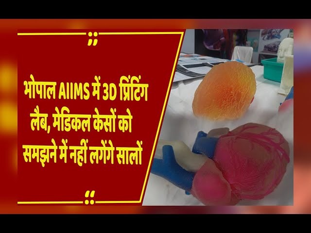 एम्स भोपाल में शुरू हुई इन-हाउस 3-डी प्रिंटिंग सुविधा, मरीजों को मिलेगा सटीक और नि:शुल्क इलाज